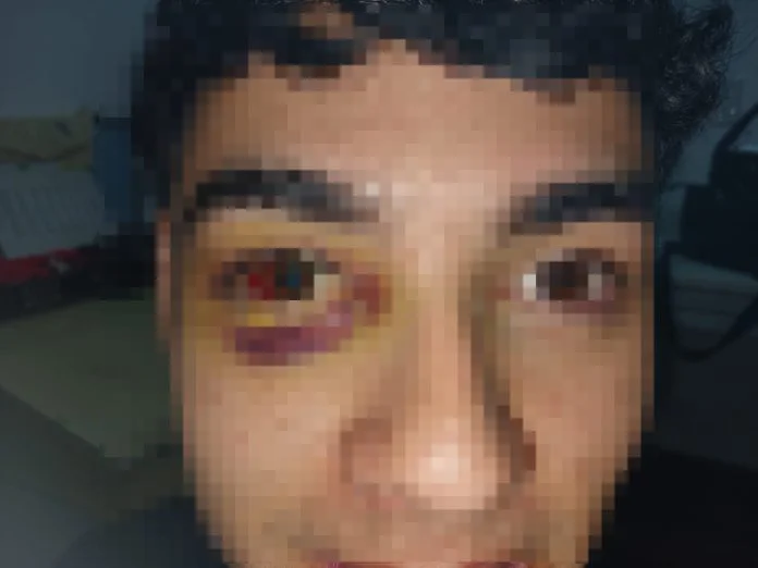 photo-output-696x522